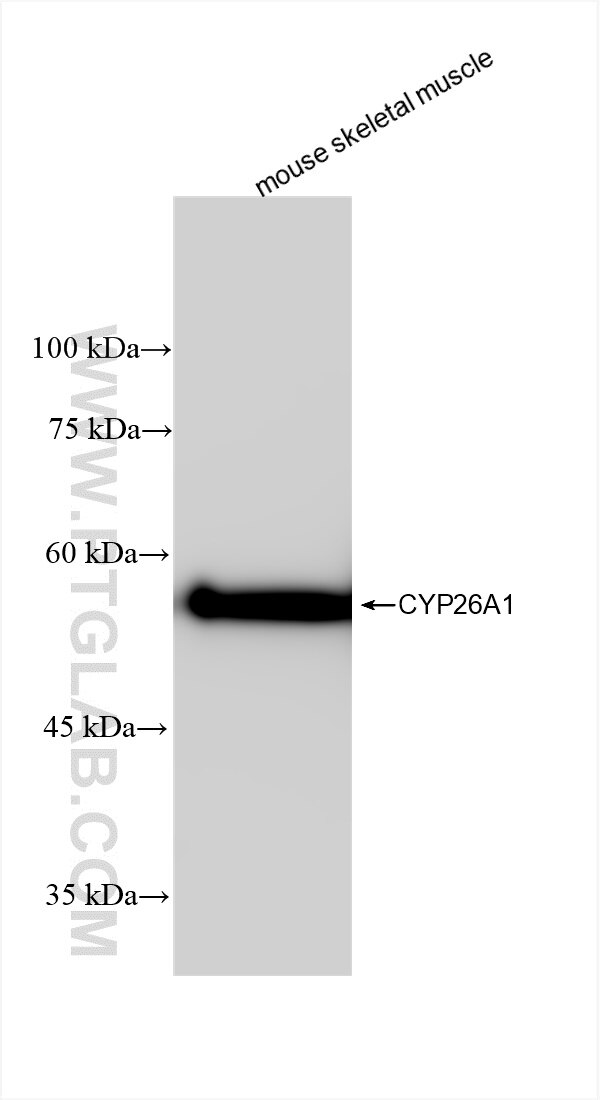 Western Blot (WB) analysis of various lysates using CYP26A1 Recombinant antibody (84699-1-RR)
