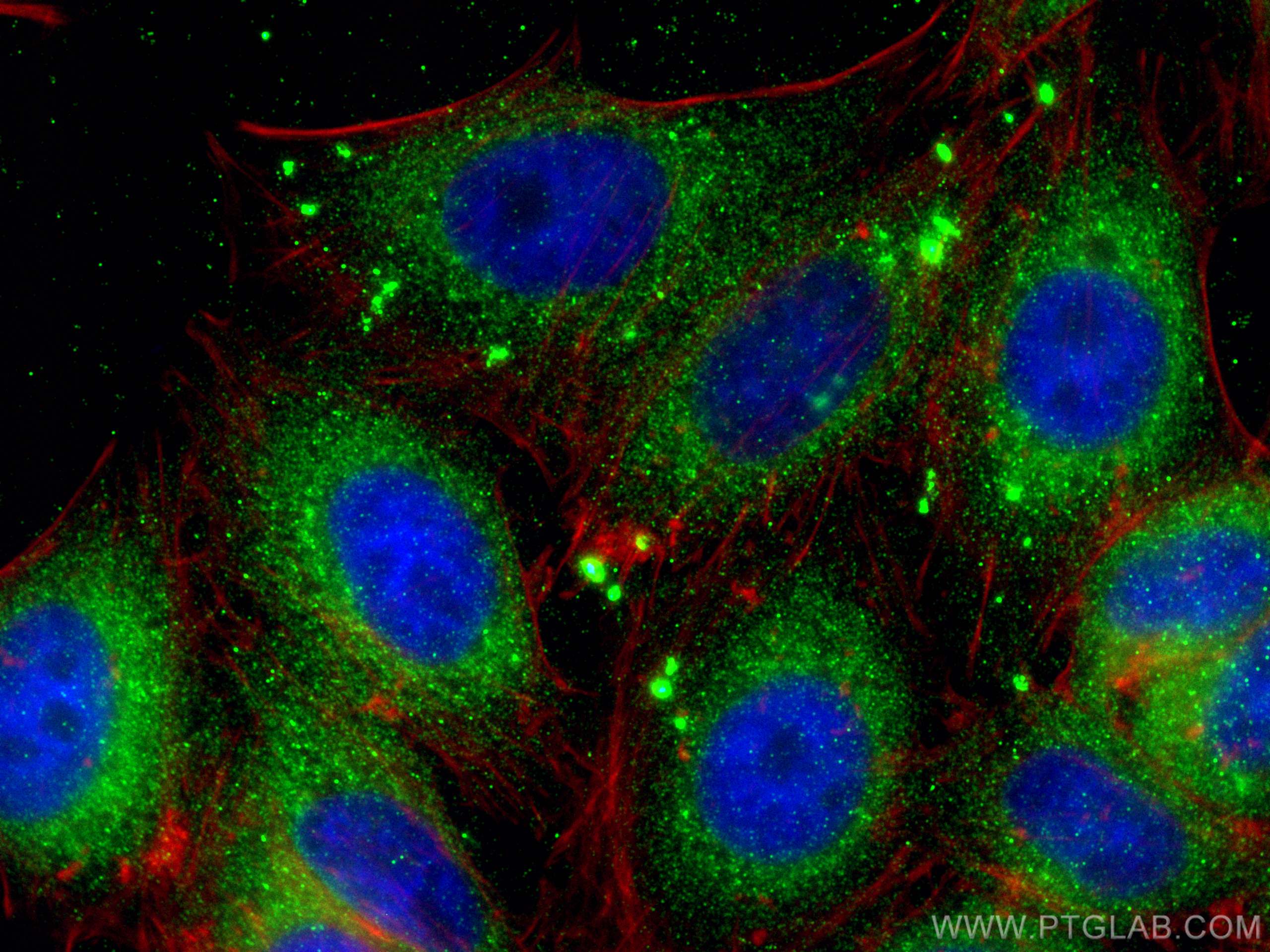 Immunofluorescence (IF) / fluorescent staining of HepG2 cells using CYP26B1 Polyclonal antibody (21555-1-AP)