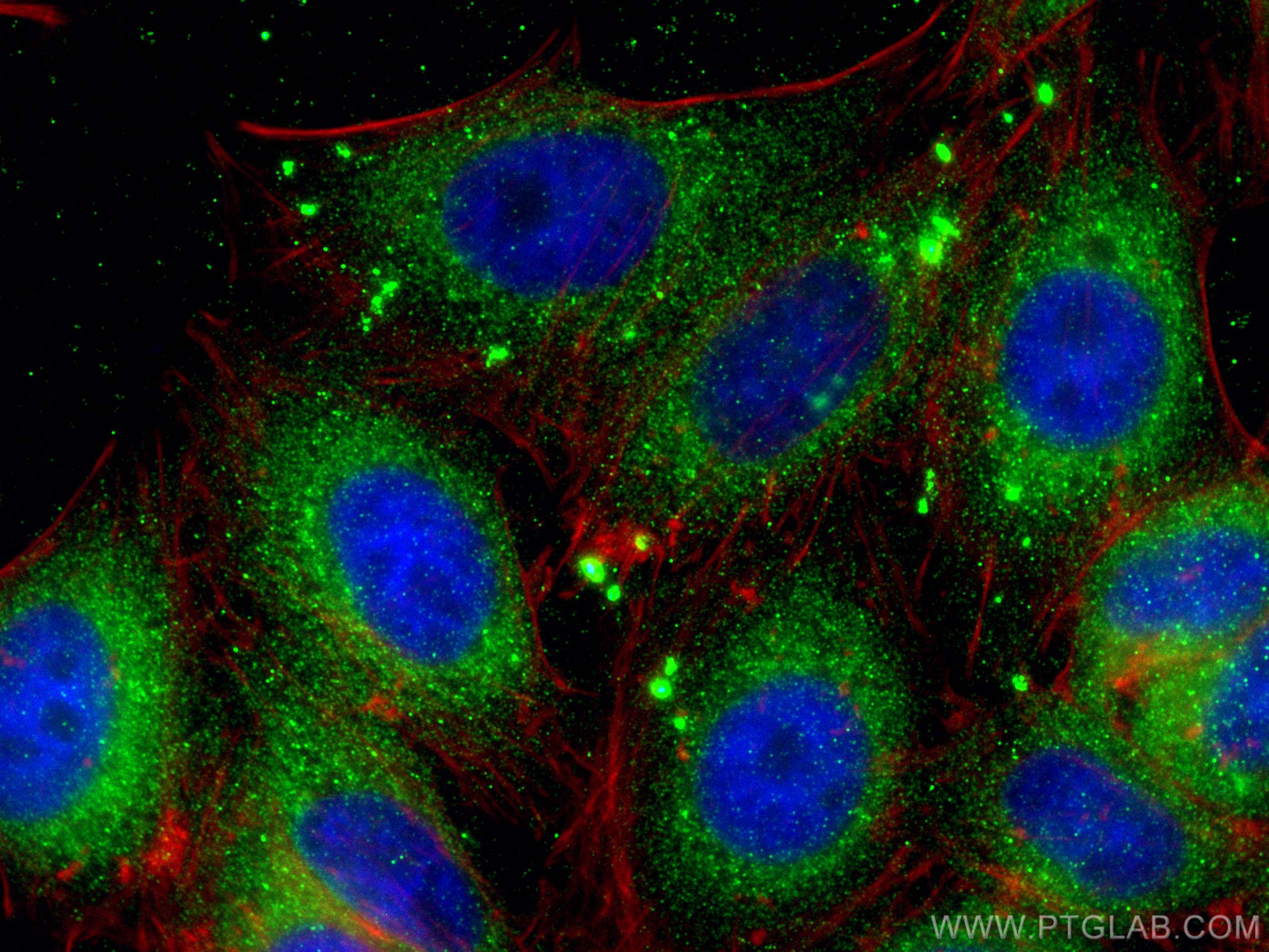 IF Staining of HepG2 using 21555-1-AP