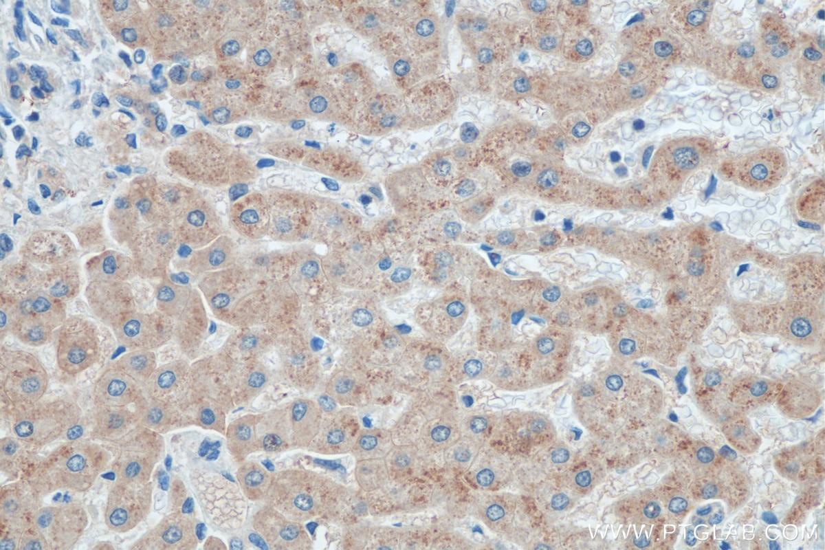 Immunohistochemistry (IHC) staining of human hepatocirrhosis tissue using CYP26B1 Polyclonal antibody (21555-1-AP)