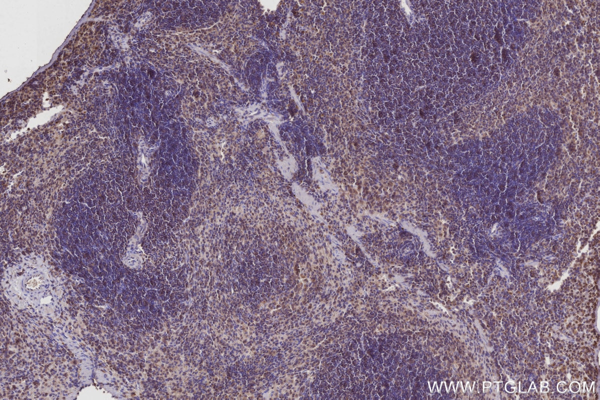 IHC staining of mouse spleen using 21555-1-AP Immunohistochemistry (IHC) staining of mouse spleen tissue using CYP26B1 Polyclonal antibody (21555-1-AP)