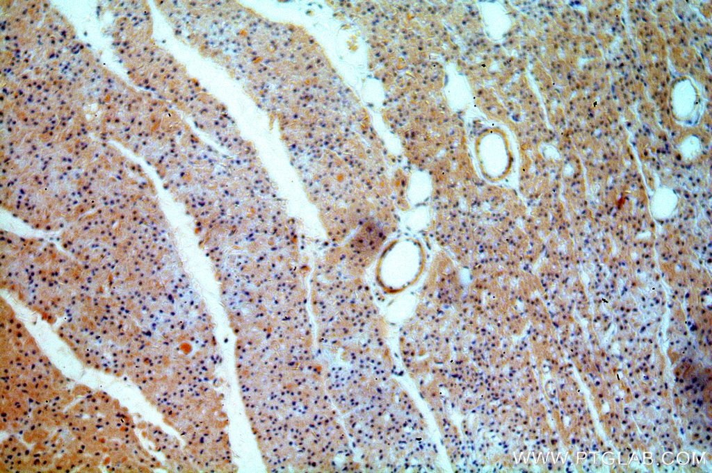 Immunohistochemistry (IHC) staining of human heart tissue using CYP26B1 Polyclonal antibody (21555-1-AP)