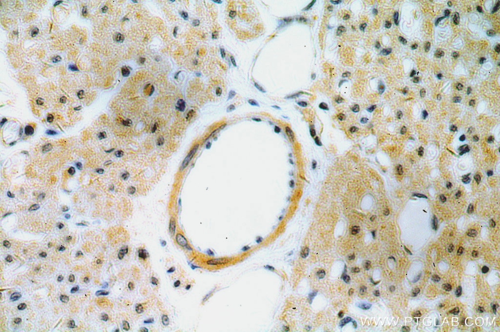 Immunohistochemistry (IHC) staining of human heart tissue using CYP26B1 Polyclonal antibody (21555-1-AP)