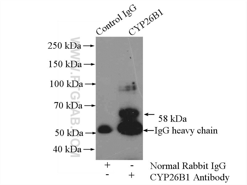 Immunoprecipitation (IP) experiment of L02 cells using CYP26B1 Polyclonal antibody (21555-1-AP)