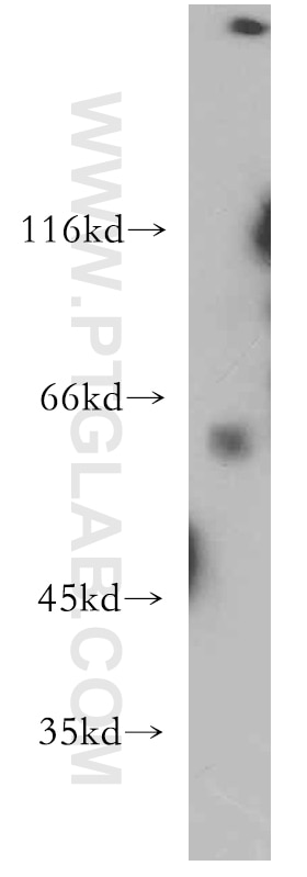 Western Blot (WB) analysis of human brain tissue using CYP26B1 Polyclonal antibody (21555-1-AP)