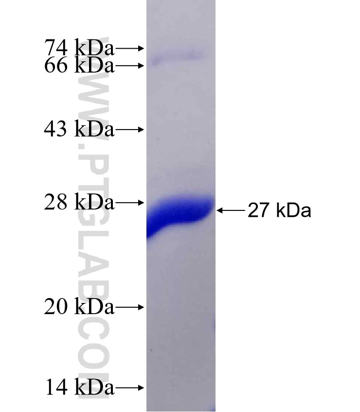 CYP26B1 fusion protein Ag17493 SDS-PAGE