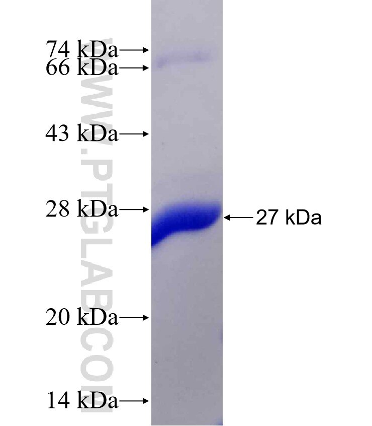 CYP26B1 fusion protein Ag17493 SDS-PAGE