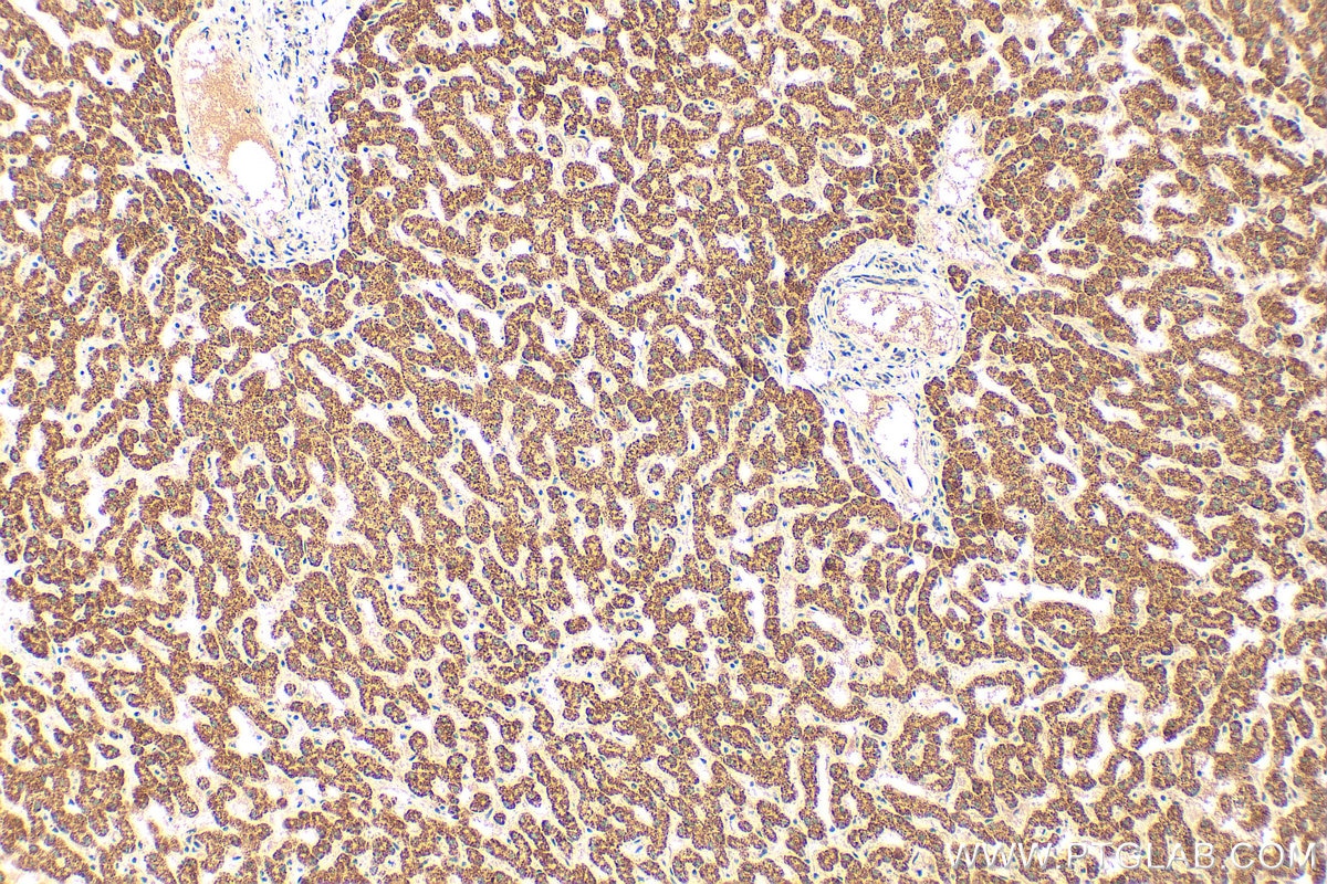 Immunohistochemistry (IHC) staining of human liver tissue using CYP27A1 Polyclonal antibody (14739-1-AP)