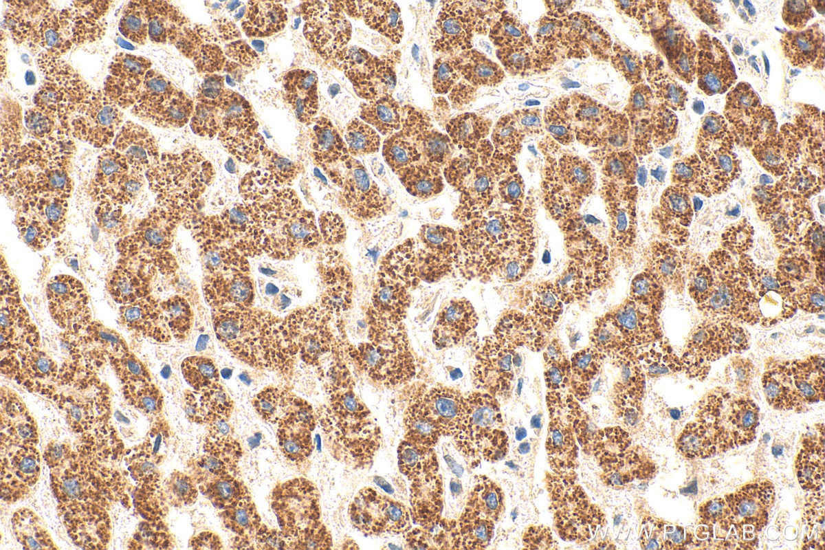 Immunohistochemistry (IHC) staining of human liver tissue using CYP27A1 Polyclonal antibody (14739-1-AP)
