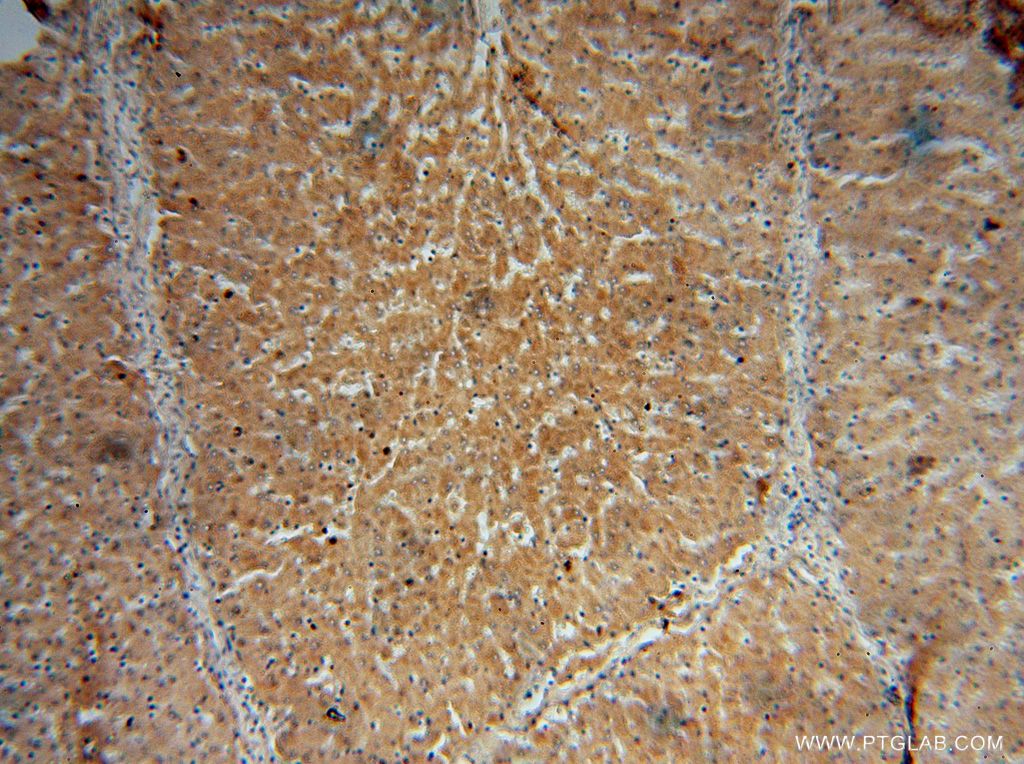 Immunohistochemistry (IHC) staining of human liver tissue using CYP27A1 Polyclonal antibody (14739-1-AP)