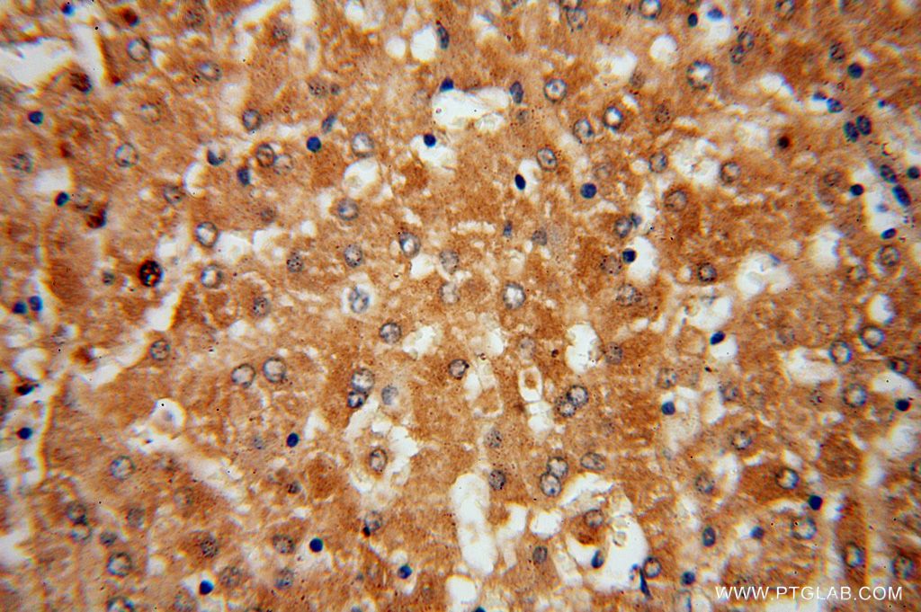 Immunohistochemistry (IHC) staining of human liver tissue using CYP27A1 Polyclonal antibody (14739-1-AP)