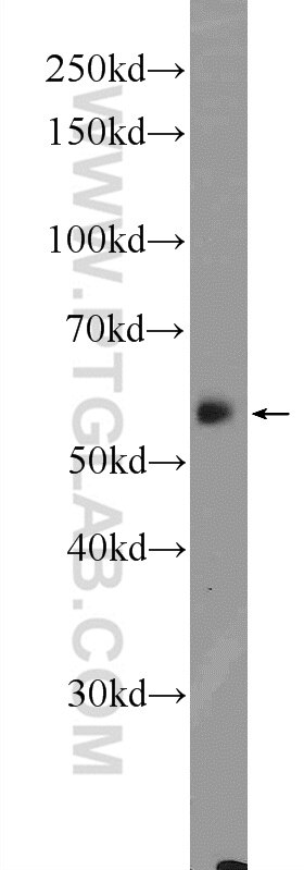 Western Blot (WB) analysis of mouse liver tissue using CYP27A1 Polyclonal antibody (14739-1-AP)
