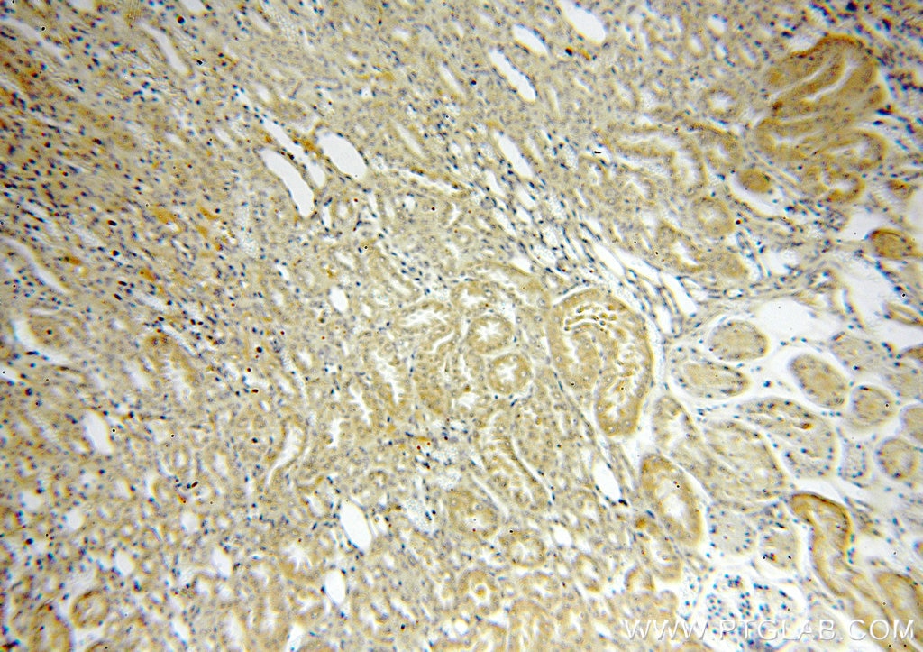 IHC staining of human kidney using 19195-1-AP
