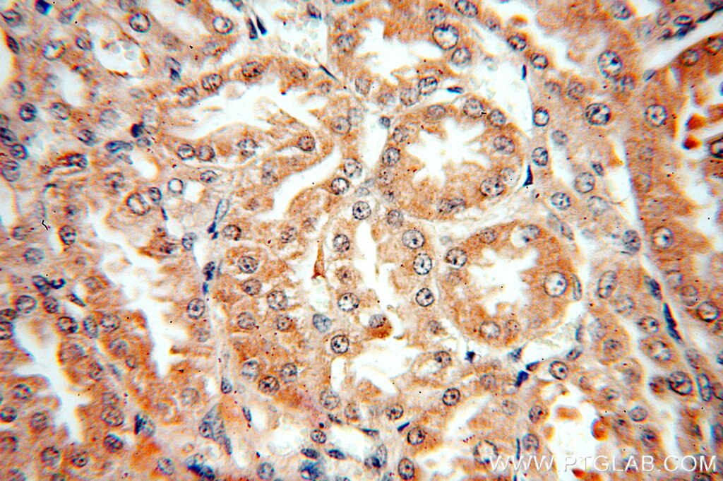 Immunohistochemistry (IHC) staining of human kidney tissue using CYP27A1 Polyclonal antibody (19195-1-AP)
