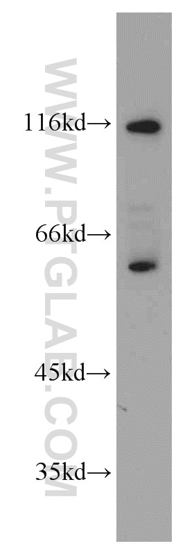 Western Blot (WB) analysis of HepG2 cells using CYP27A1 Polyclonal antibody (19195-1-AP)