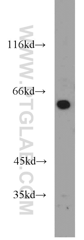 Western Blot (WB) analysis of L02 cells using CYP27A1 Polyclonal antibody (19195-1-AP)