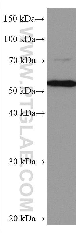 Western Blot (WB) analysis of Caco-2 cells using CYP27A1 Monoclonal antibody (67045-1-Ig)