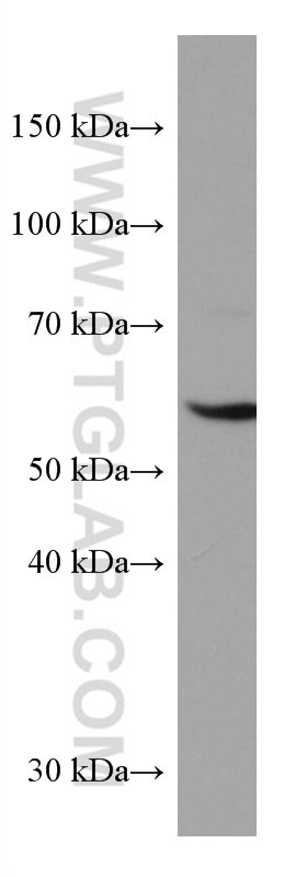 Western Blot (WB) analysis of HepG2 cells using CYP27A1 Monoclonal antibody (67045-1-Ig)