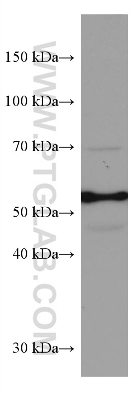 Western Blot (WB) analysis of HT-29 cells using CYP27A1 Monoclonal antibody (67045-1-Ig)