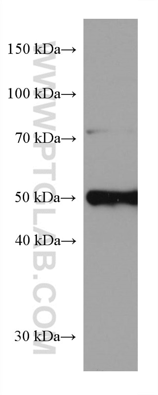 Western Blot (WB) analysis of rat liver tissue using CYP27A1 Monoclonal antibody (67045-1-Ig)