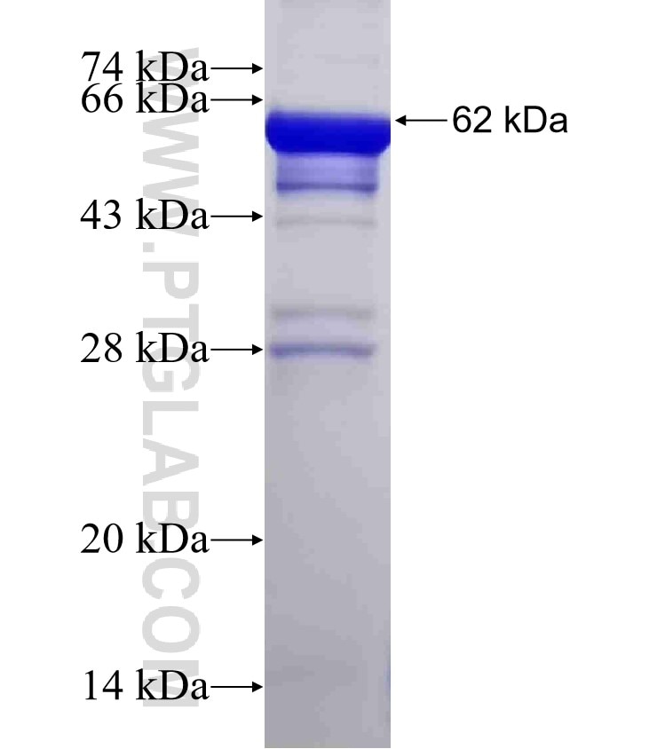 CYP27A1 fusion protein Ag6408 SDS-PAGE