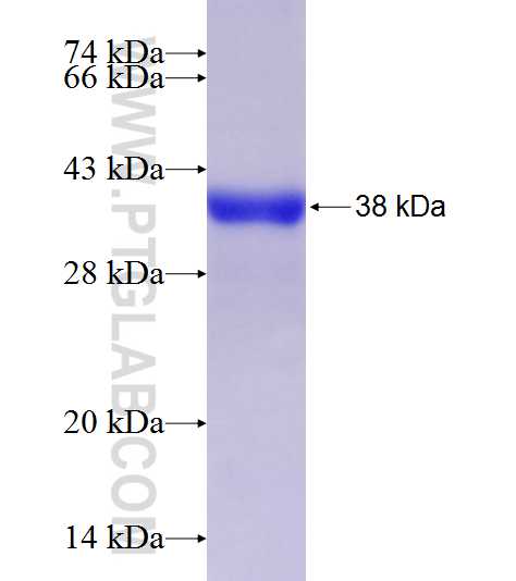 CYP27A1 fusion protein Ag7746 SDS-PAGE