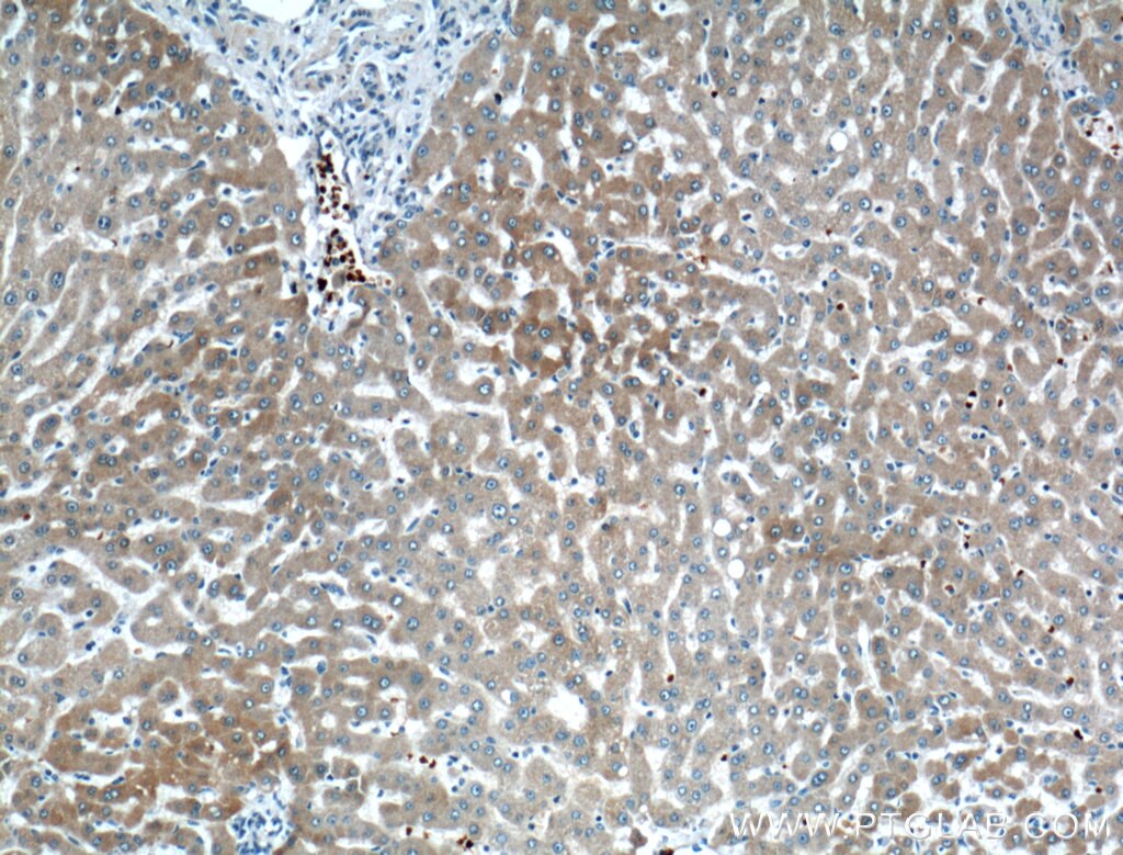 Immunohistochemistry (IHC) staining of human liver tissue using CYP2A6 Polyclonal antibody (21721-1-AP)