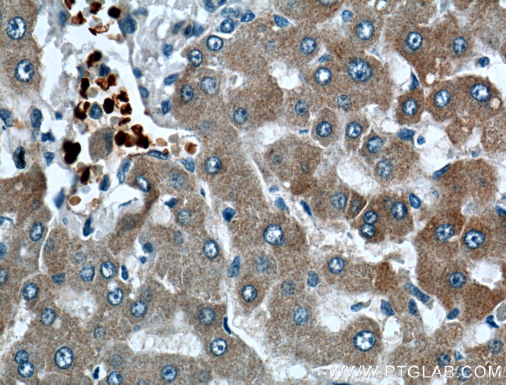 Immunohistochemistry (IHC) staining of human liver tissue using CYP2A6 Polyclonal antibody (21721-1-AP)