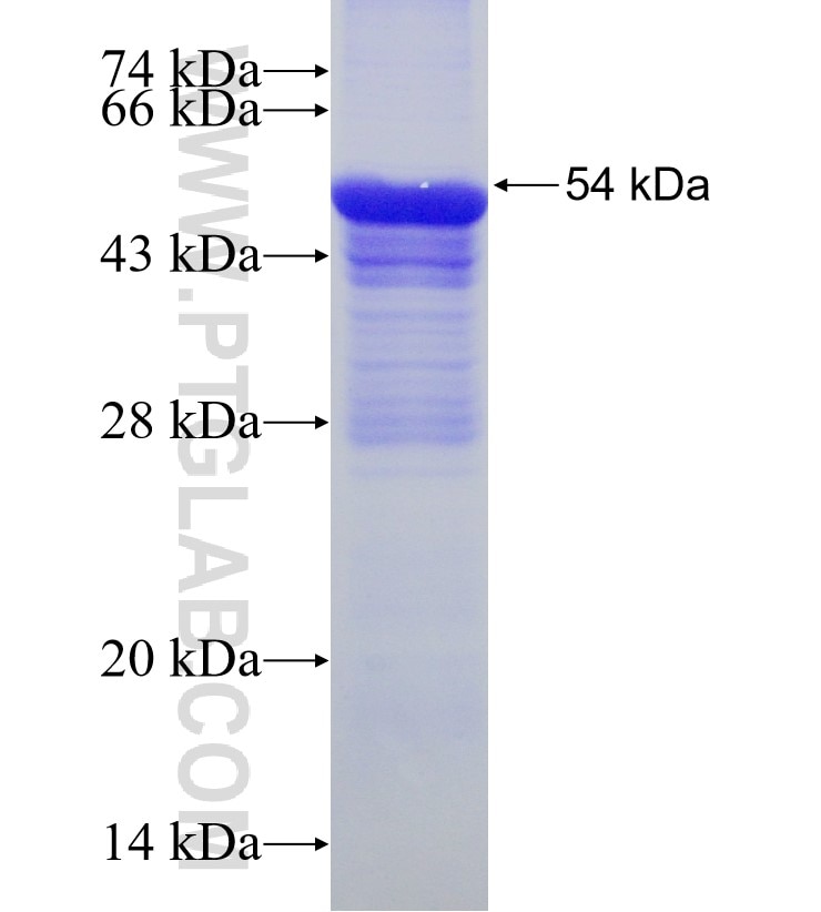 CYP2A6 fusion protein Ag16377 SDS-PAGE