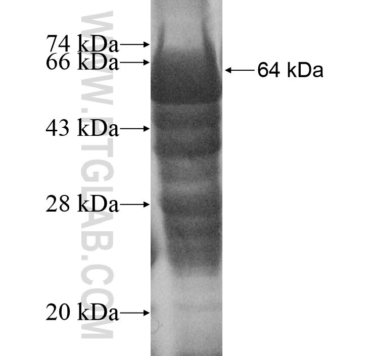 CYP2B7P1 fusion protein Ag11588 SDS-PAGE