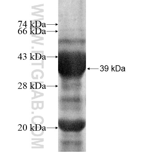 CYP2B7P1 fusion protein Ag11618 SDS-PAGE