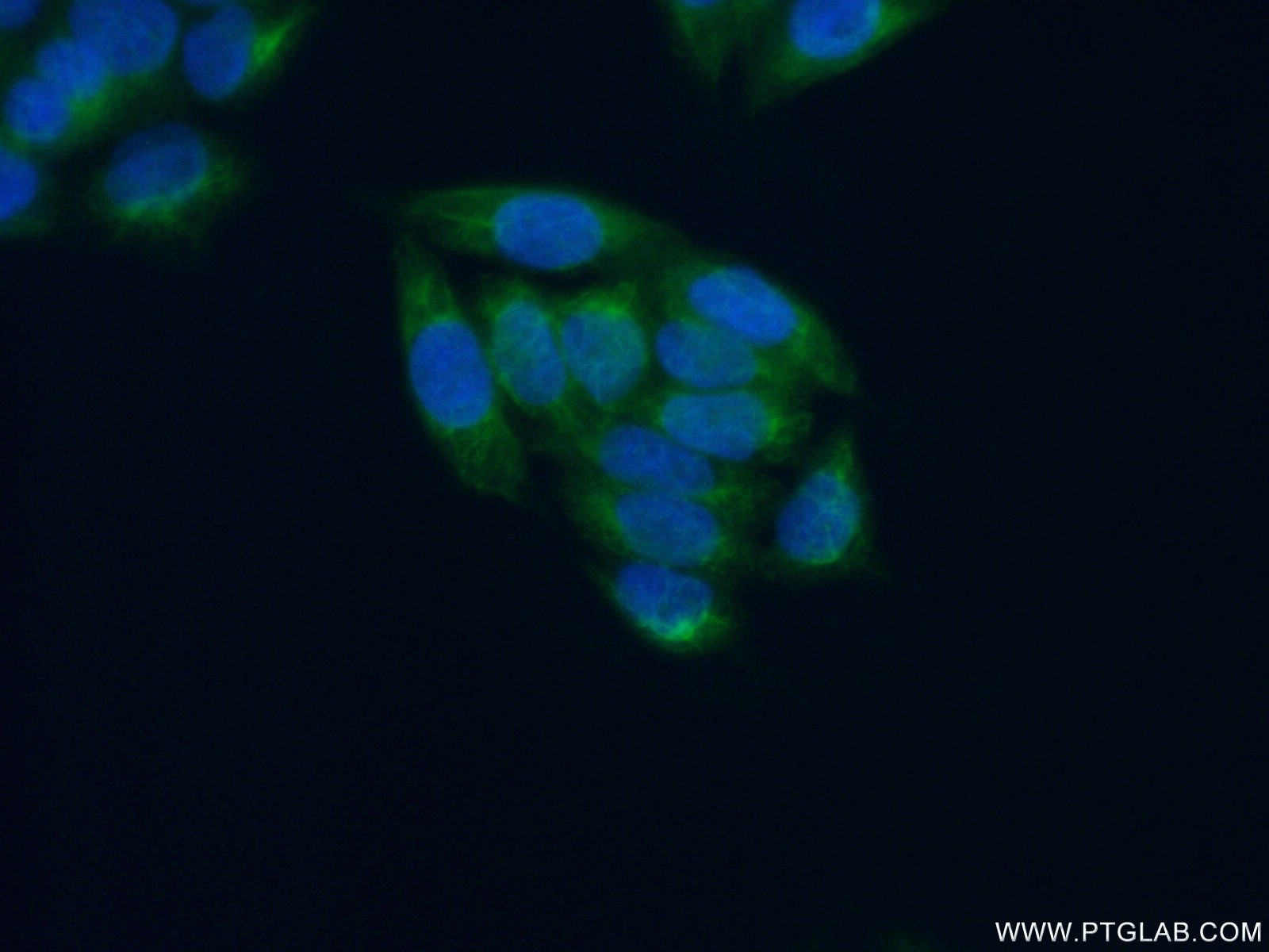 Immunofluorescence (IF) / fluorescent staining of HeLa cells using CYP2C19 Polyclonal antibody (55453-1-AP)