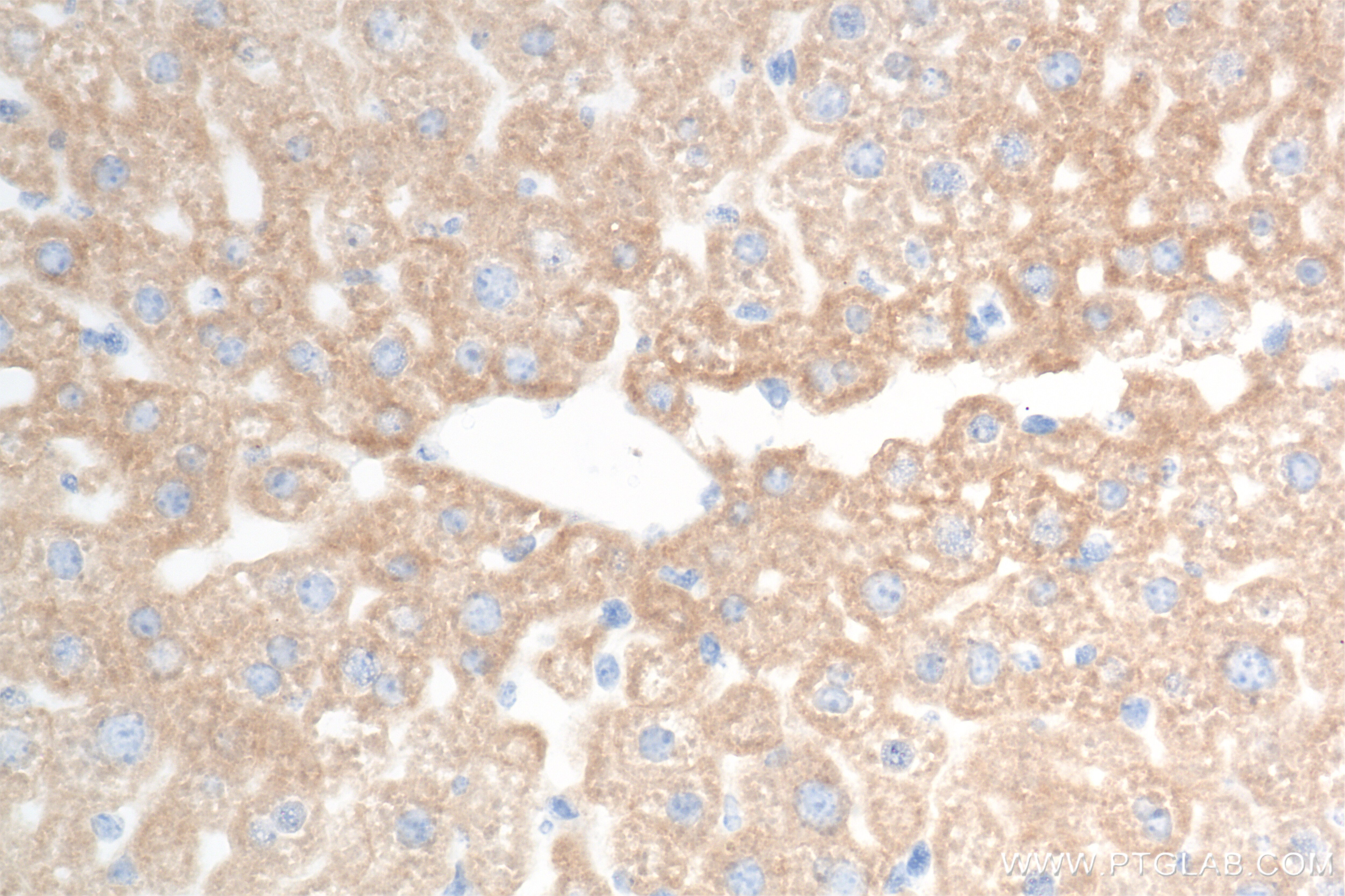 Immunohistochemistry (IHC) staining of mouse liver tissue using CYP2C8 Recombinant antibody (85717-1-RR)