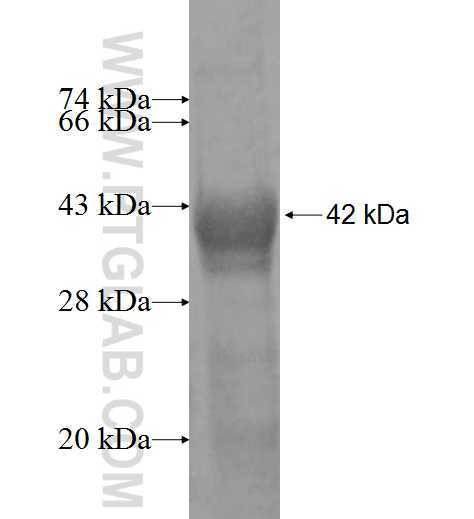 CYP2C8 fusion protein Ag9898 SDS-PAGE