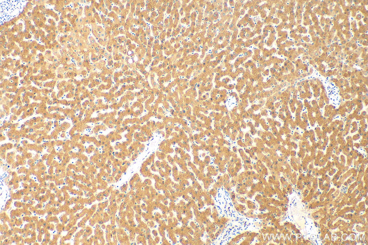 Immunohistochemistry (IHC) staining of human liver tissue using CYP2C9 Polyclonal antibody (16355-1-AP)