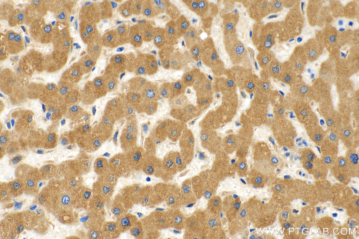 Immunohistochemistry (IHC) staining of human liver tissue using CYP2C9 Polyclonal antibody (16355-1-AP)