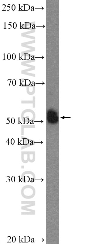 Western Blot (WB) analysis of SMMC-7721 cells using CYP2C9 Polyclonal antibody (16355-1-AP)