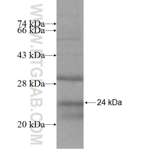 CYP2C9 fusion protein Ag9881 SDS-PAGE