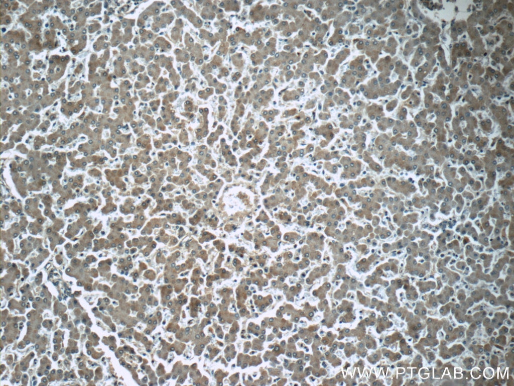 IHC staining of human liver using 17868-1-AP