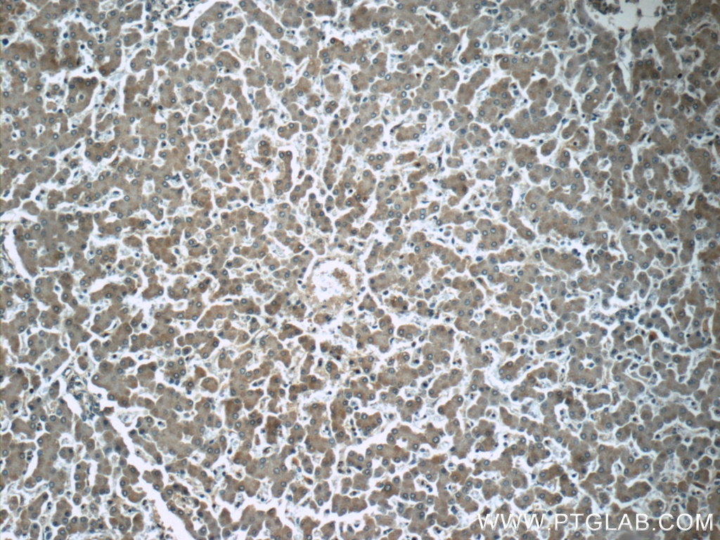 Immunohistochemistry (IHC) staining of human liver tissue using CYP2D6/7 Polyclonal antibody (17868-1-AP)