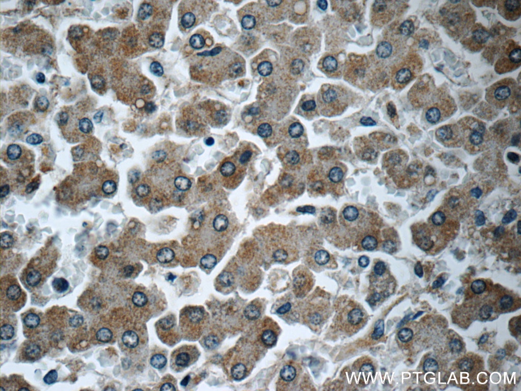 Immunohistochemistry (IHC) staining of human liver tissue using CYP2D6/7 Polyclonal antibody (17868-1-AP)