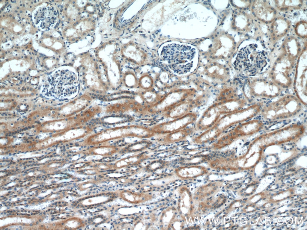 Immunohistochemistry (IHC) staining of human kidney tissue using CYP2D6/7 Polyclonal antibody (17868-1-AP)