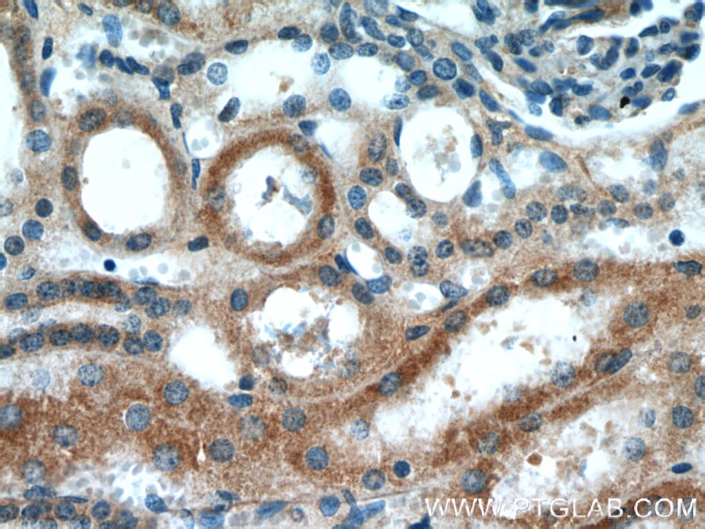 Immunohistochemistry (IHC) staining of human kidney tissue using CYP2D6/7 Polyclonal antibody (17868-1-AP)