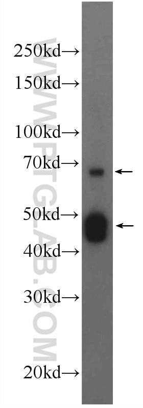 CYP2D6/7 Polyclonal antibody