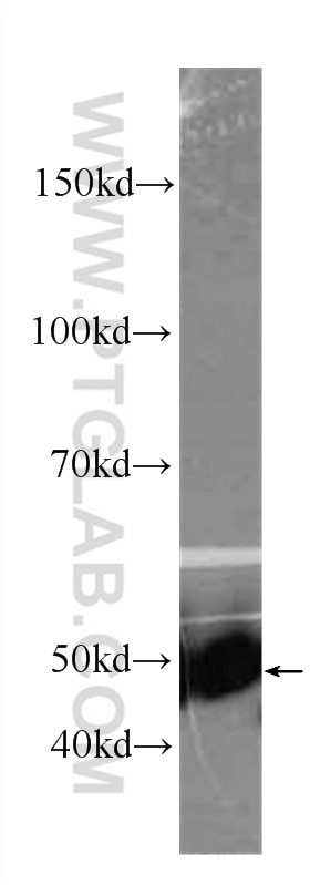 Western Blot (WB) analysis of fetal human brain tissue using CYP2D6 Monoclonal antibody (60297-1-Ig)