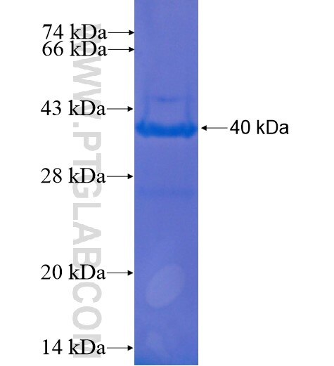 CYP2D6 fusion protein Ag12605 SDS-PAGE