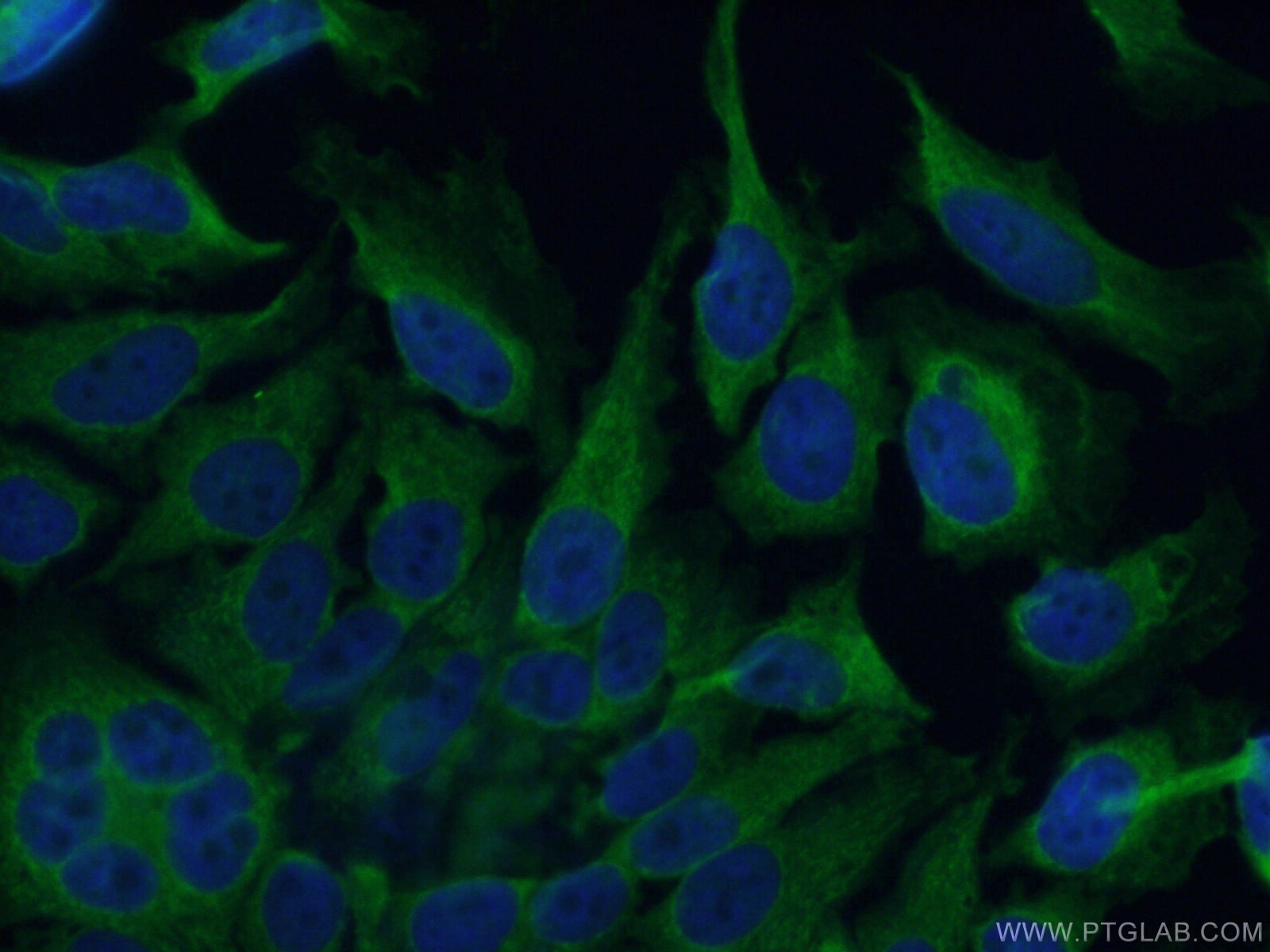 Immunofluorescence (IF) / fluorescent staining of HeLa cells using CYP2E1-Specific Polyclonal antibody (19937-1-AP)