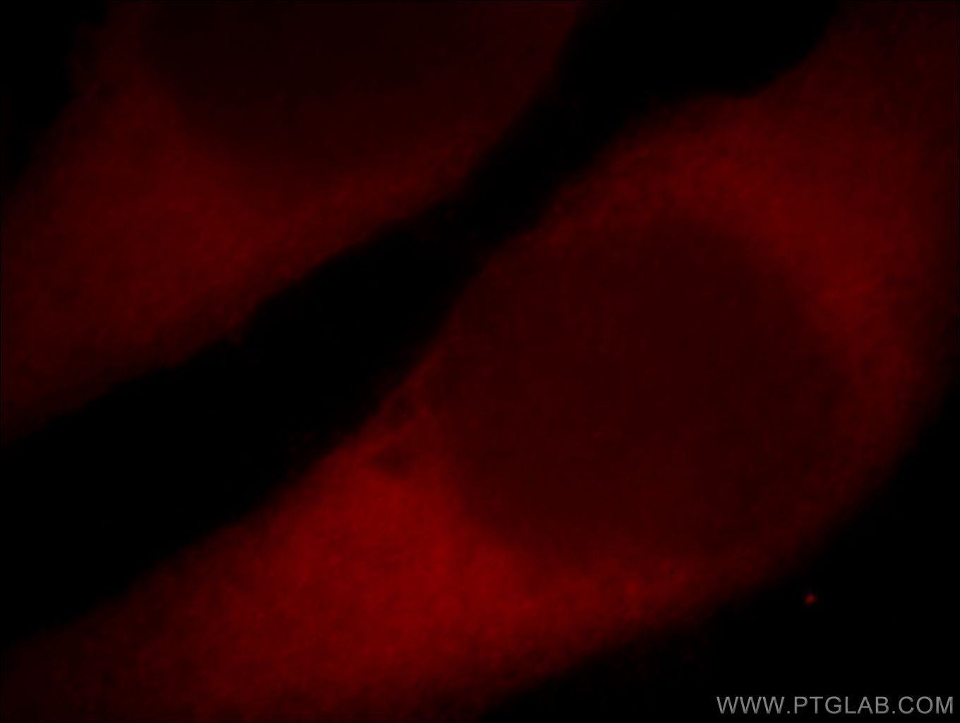 Immunofluorescence (IF) / fluorescent staining of HeLa cells using CYP2E1-Specific Polyclonal antibody (19937-1-AP)