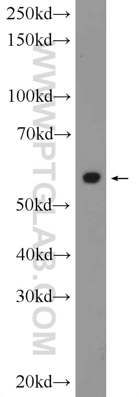 Western Blot (WB) analysis of Jurkat cells using CYP2E1-Specific Polyclonal antibody (19937-1-AP)