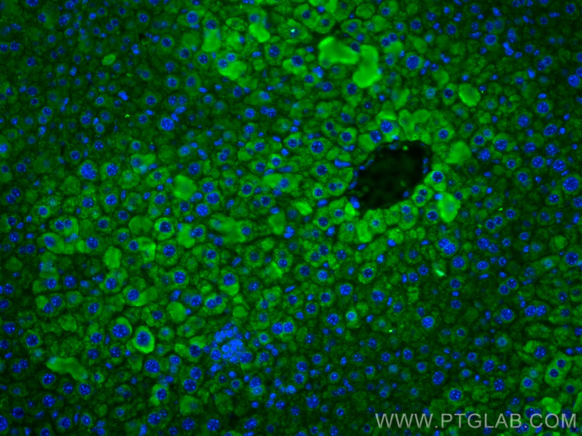 Immunofluorescence (IF) / fluorescent staining of mouse liver tissue using CYP2E1-Specific Monoclonal antibody (67263-1-Ig)